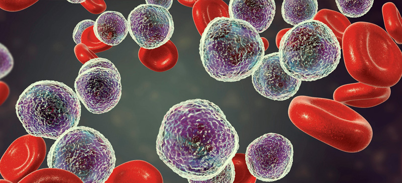 cineole-leukemia-cancer