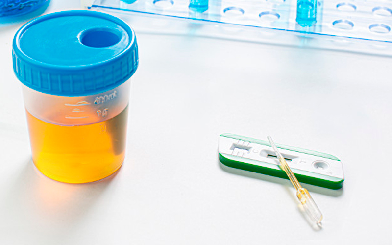urine-test